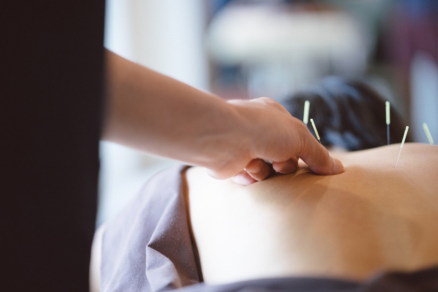 How Acupuncture Treatments Can Reduce Pain and Inflammation
