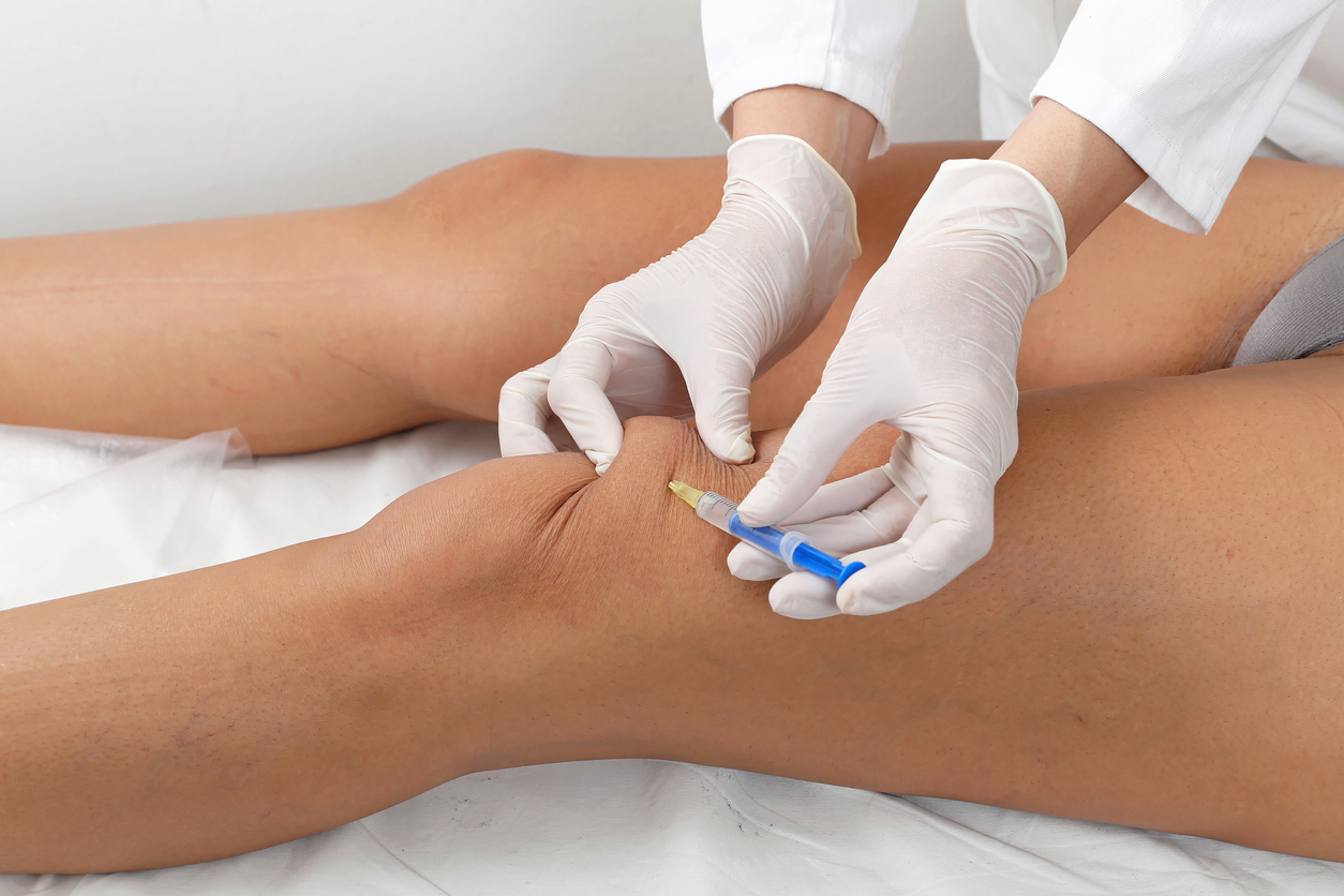 The Benefits Of Prolotherapy in Calgary