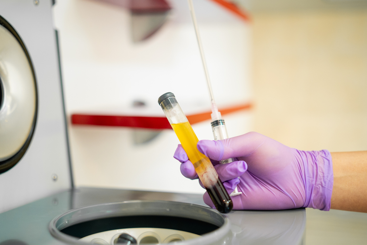 What Are The Cost Of PRP & Prolotherapy Treatments in Calgary?