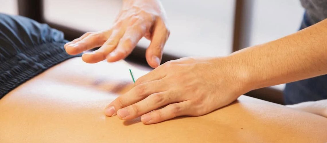 calgary acupuncture