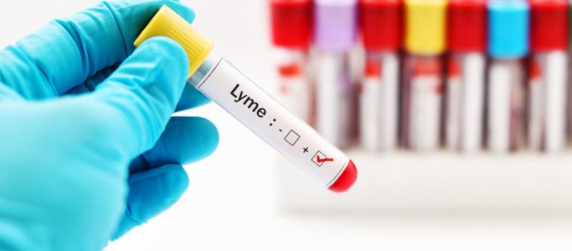 Lyme disease testing