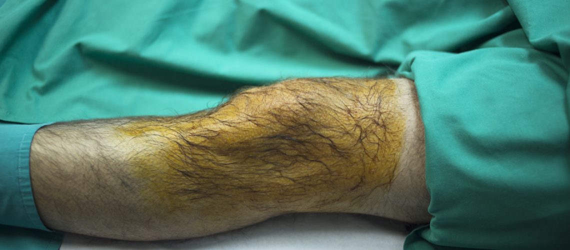 Prolotheraphy